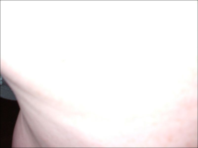 DSCF2544